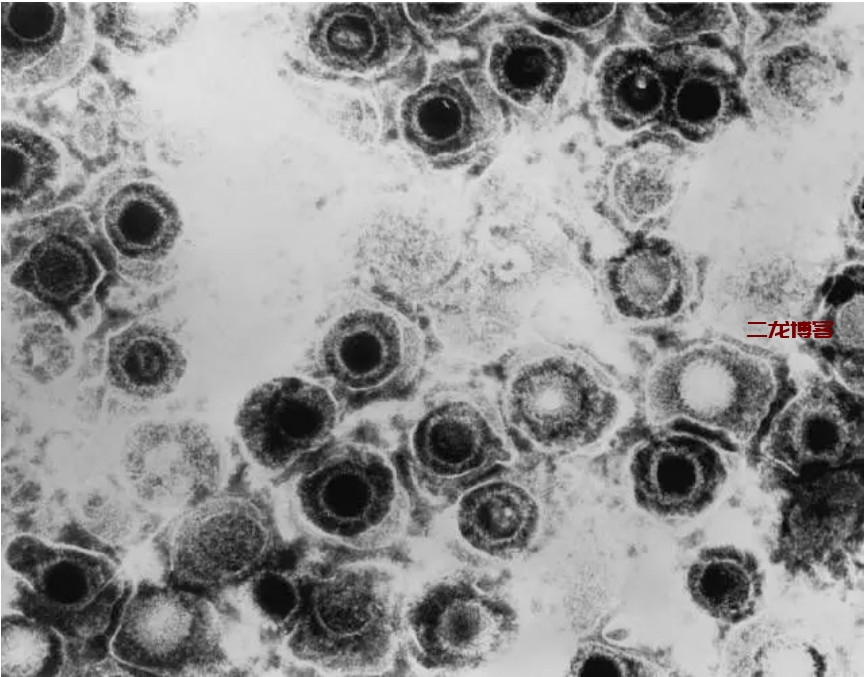 了解细菌、病毒、传染病等基础知识，更好的认识2019新型冠状病毒